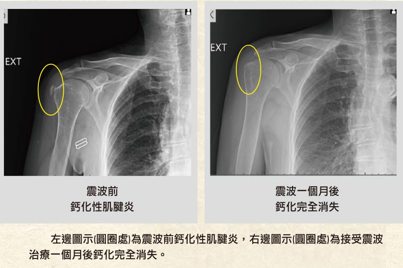 豐原慈濟宮